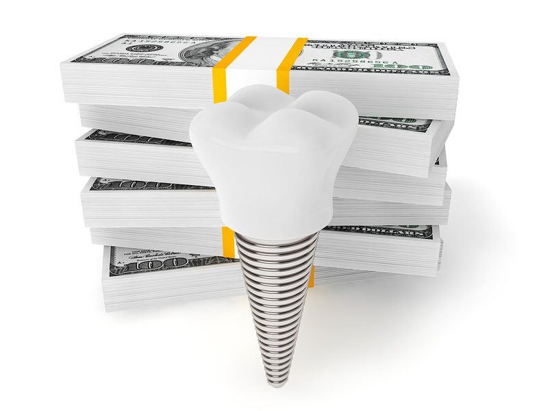 dental implant financing Rockwall