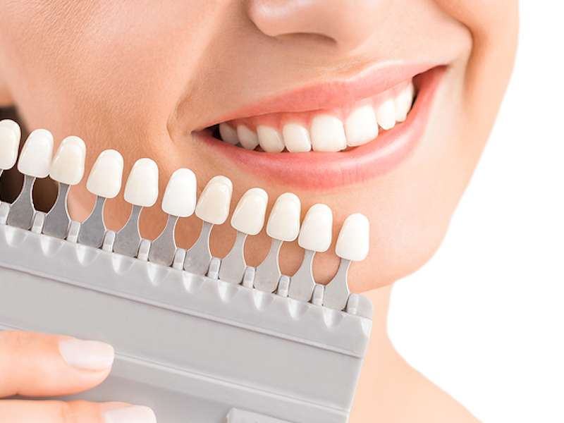 Heath,McLendon-Chisholm cosmetic smile makeover