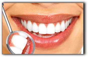 porcelain veneers cost Rockwall