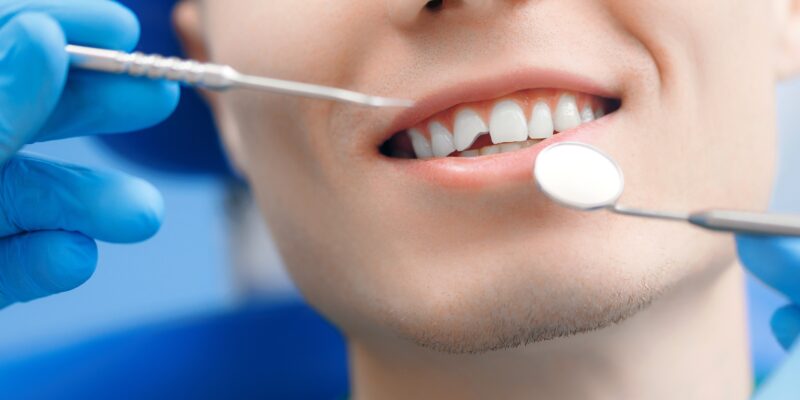 dentist in blue gloves examining a patients chipped front tooth